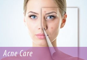 medical acne skin care cda